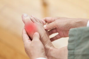 The “Gout Killer” Mainstream Medicine Completely IGNORED