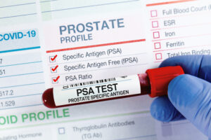 Discarded “Fruit Fiber” Buys Prostate Cancer Patients 4X More Time
