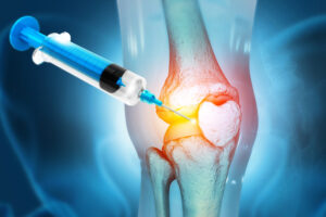 Is This the Real Fix for Aging Knees?