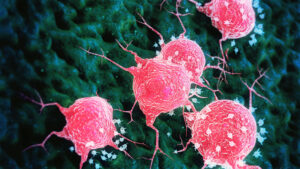 Proven Cancer Killer Being Blacklisted in America?