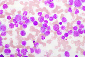Boosted Leukemia Survival 71% — And NOBODY Is Talking About It