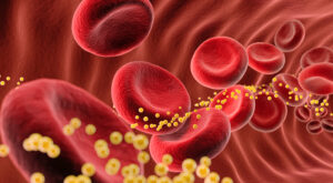Coming Soon! The Most TERRIFYING Cholesterol Treatment Yet