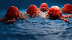 The Mineral That SHRINKS Tumors 45%?
