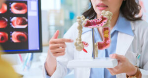 Keep Your Colon Cancer-Free with This All-Natural Compound